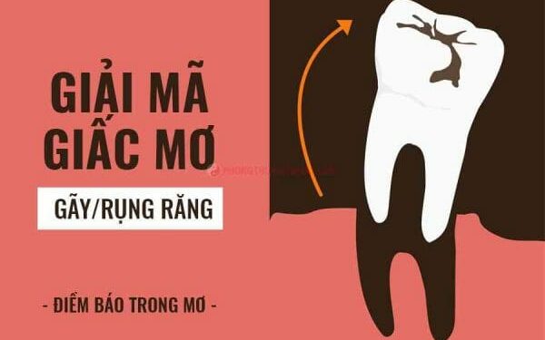 Nằm Mơ Thấy Rụng Răng Là Điềm Tốt Hay Xấu? Đánh Số Bao Nhiêu? 1 nam-mo-thay-rung-rang-la-diem-lanh-hay-xau